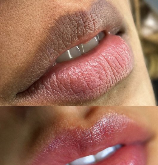 Antes e depois labial, trabalho realizado por Raynã Luzie